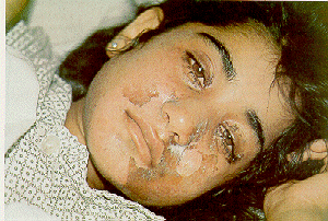 halabje.gif